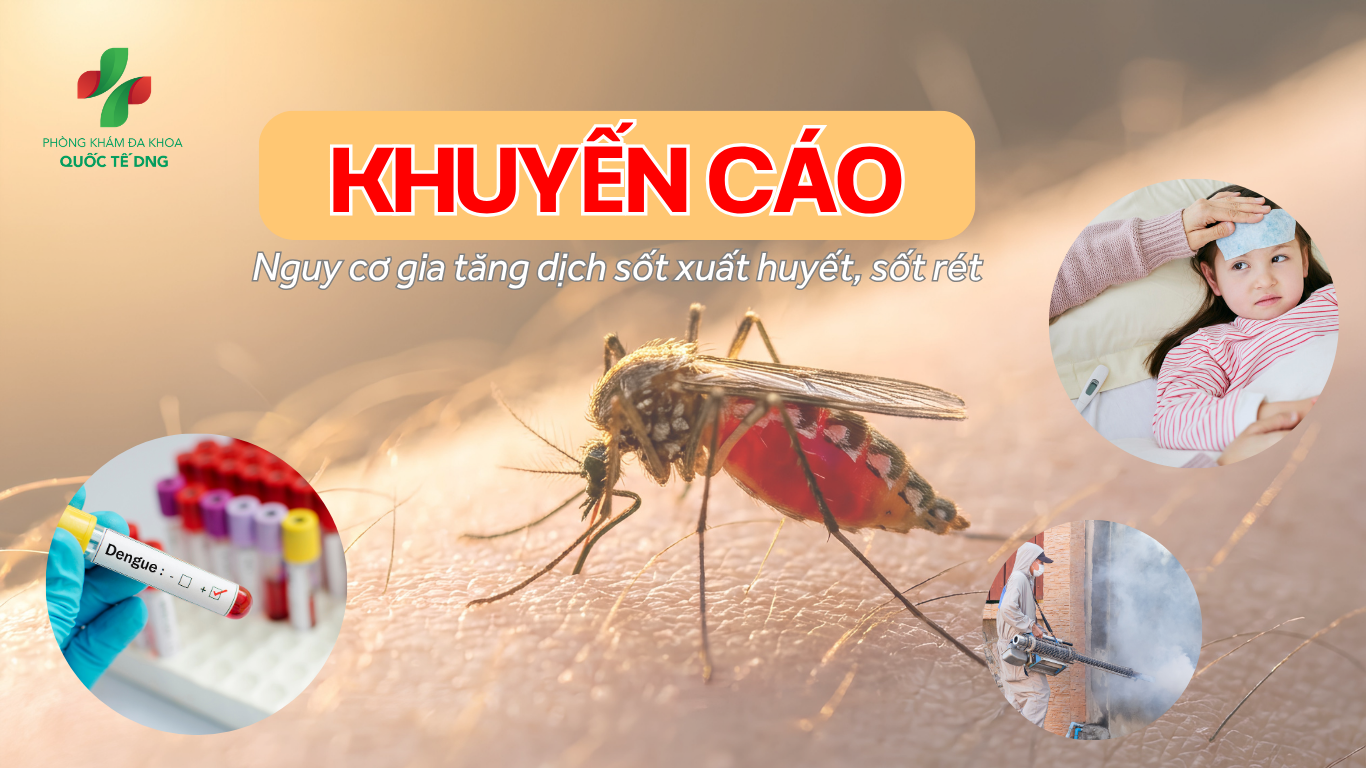 Sốt xuất huyết 