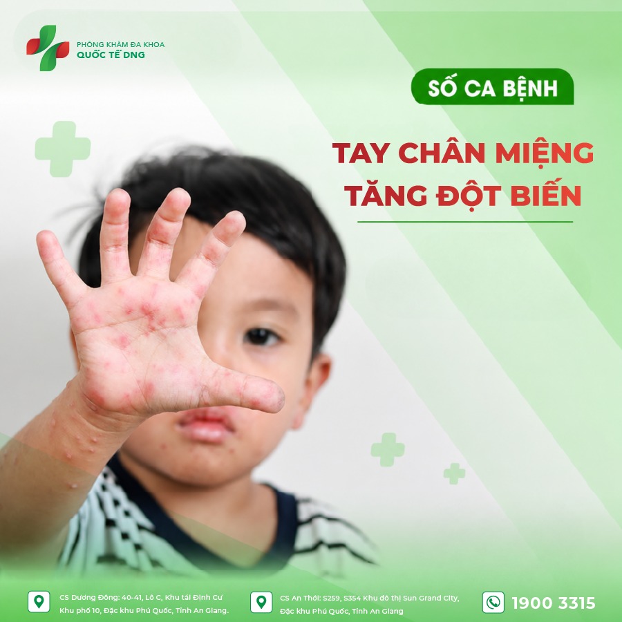 chân tay miệng ở trẻ
