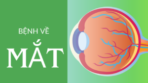 bệnh về mắt