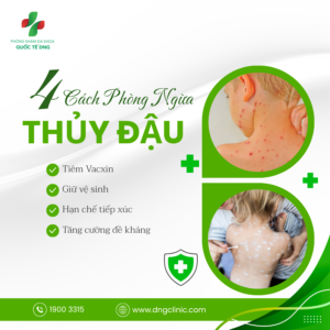 phòng ngừa thủy đậu
